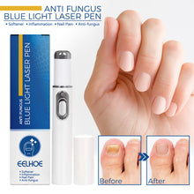 Load image into Gallery viewer, Nail Blue Light Laser Pen Onychomycosis Repair Laser Pen Restoring Nail Health Removing Odor Nail Care Tool
