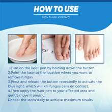 Load image into Gallery viewer, Nail Blue Light Laser Pen Onychomycosis Repair Laser Pen Restoring Nail Health Removing Odor Nail Care Tool
