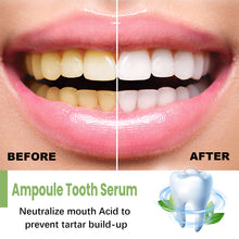Load image into Gallery viewer, Tooth Whitening Essence Cleaning Dental Stains Improving Oral Odor Whitening Tooth Essence Oral Hygiene Care
