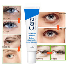 Load image into Gallery viewer, Eye Cream Repair Skin Barrier for Dark Circles Under Eyes Moisturizing Reducing Black Circle Eye Cream Whitening Anti-Fine Lines Eye Care
