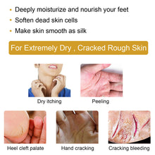 Load image into Gallery viewer, Heel Cracking Banana Cream Winter Moisturizing Hand and Foot Cream Anti Dry Cracking Banana Essence Cream
