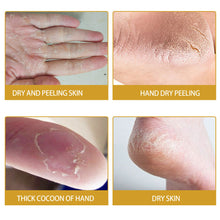 Load image into Gallery viewer, Heel Cracking Banana Cream Winter Moisturizing Hand and Foot Cream Anti Dry Cracking Banana Essence Cream
