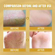 Load image into Gallery viewer, Heel Cracking Banana Cream Winter Moisturizing Hand and Foot Cream Anti Dry Cracking Banana Essence Cream
