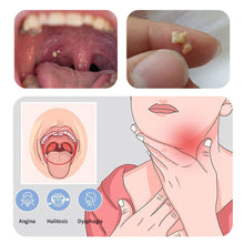 Load image into Gallery viewer, Tonsil Stone Removal Tool LED Light Stainless Steel Remover Mouth Cleaning Care Tool Tonsil Stone Remover Cleaning Tools
