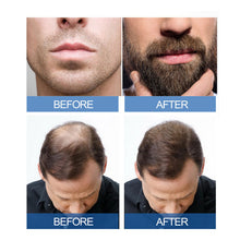 Load image into Gallery viewer, 1 Minoxidil with Dropper Hair Grower Beard Grower Creative Effective Hair Growth Health Care
