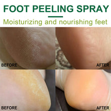 Load image into Gallery viewer, Foot Exfoliation Spray Remove Calluses Dead Skin Moisturizing Nourishing Foot Skin Green Tea Citrus Flavor Foot Care Spray
