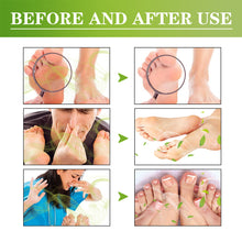 Load image into Gallery viewer, Deodorizing Foot Spray Relieving Smelly Sweaty Feet Reducing Bacteria Wild Deodorous Fragrant Foot Care Spray
