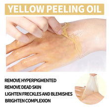 Load image into Gallery viewer, Whitening Exfoliating Oil Deep Cleansing Exfoliating Dead Skin Fading Spots Brightening Complexion Skin Care Oil
