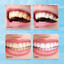 Load image into Gallery viewer, Tooth Stain Cleaning Brush Deep Cleaning Gums Oral Cavity Brightening Teeth Portable Durable Tooth Cleaning Tool
