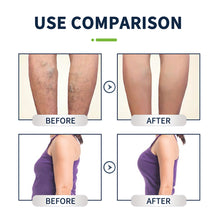 Load image into Gallery viewer, Herbal Shaping Foot Bath Bag Relieving Body Fatigue Improving Metabolism Repairing Veins Health Care Foot Bath Bag
