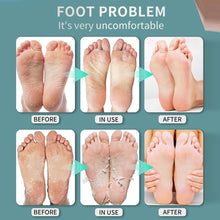 Load image into Gallery viewer, Foot Beriberi Spray Foot Itching Foot Odor Sweat Foot Care Liquid Mild Non Irritating Antibacterial Foot Spray
