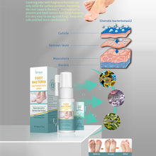 Load image into Gallery viewer, Foot Beriberi Spray Foot Itching Foot Odor Sweat Foot Care Liquid Mild Non Irritating Antibacterial Foot Spray
