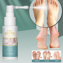 Load image into Gallery viewer, Foot Beriberi Spray Foot Itching Foot Odor Sweat Foot Care Liquid Mild Non Irritating Antibacterial Foot Spray
