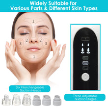 Load image into Gallery viewer, Small Bubble Beauty Instrument Household Pore Cleaning Introduction Oxygen Injection Instrument Electric Blackhead Removal Artifact
