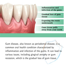 Load image into Gallery viewer, Gingival Repair Drops Reducing Inflammation Discomfort Relieving Dental Problems Oral Cleaning Care Drops
