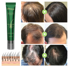 Load image into Gallery viewer, Hair Growth Oil Prevent Hair Loss Strengthen Hair Care Prevent Hair Breakage Ginger Hair Care Damage Repair Hair Care
