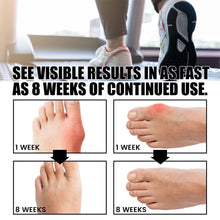 Load image into Gallery viewer, Anti-bunions Health Sock Promoting Blood Circulation Reducing Pain Swelling Relaxing Joints Comfortable Breathable Foot Care Sock
