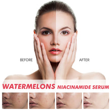 Load image into Gallery viewer, Watermelon Glow Nicotinamide Facial Moisturizing&amp;Brightening Essence Women's Spot Lightening Essence Highlighter
