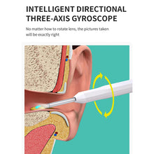 Load image into Gallery viewer, Intelligent Wireless Visual Ear Pick Rechargeable Luminous High Definition Endoscope Ear Wax Cleaning Tool Ear Care
