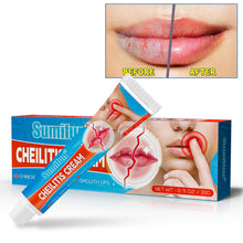 Load image into Gallery viewer, Cheilitis Cream Relieving Lip Discomfort Promoting Lip Health Moisturizing Lip Fading Lip Lines Health Care Cream
