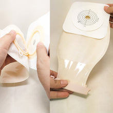 Load image into Gallery viewer, Two Piece Open Artificial Anal Ostomy Pocket for Medical Drainage Drainable Pouches with Hoop Barriers Ostomy Supplies Health Care
