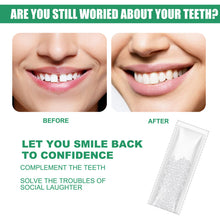 Load image into Gallery viewer, Resin Tooth Repair Glue Shapeable Teeth Gaps Glue Solid Special Effect Makeup Denture Modification Temporary Teeth Filling Glue
