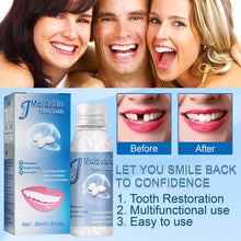 Load image into Gallery viewer, Resin Tooth Repair Glue Shapeable Teeth Gaps Glue Solid Special Effect Makeup Denture Modification Temporary Teeth Filling Glue
