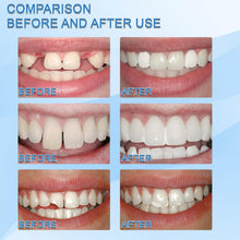 Load image into Gallery viewer, Resin Tooth Repair Glue Shapeable Teeth Gaps Glue Solid Special Effect Makeup Denture Modification Temporary Teeth Filling Glue
