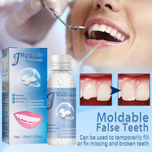 Load image into Gallery viewer, Resin Tooth Repair Glue Shapeable Teeth Gaps Glue Solid Special Effect Makeup Denture Modification Temporary Teeth Filling Glue
