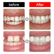 Load image into Gallery viewer, Temporary Tooth Repair Kit Teeth And Gaps FalseTeeth Solid Glue Denture Adhesive Teeth Whitening Tooth Beauty Tool
