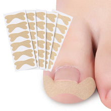 Load image into Gallery viewer, Toenail Correction Patches Ingrown Toenail Corrector Stickers Paronychia Inlaid Nail Restoration Patches Nail Tools
