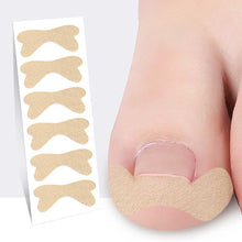Load image into Gallery viewer, Toenail Correction Patches Ingrown Toenail Corrector Stickers Paronychia Inlaid Nail Restoration Patches Nail Tools
