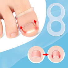 Load image into Gallery viewer, Ingrown Toenail Corrector Ring Elastic Washable Reusable Toenail Correction Silicone Ring Paronychia Restoration Tool
