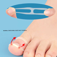 Load image into Gallery viewer, Ingrown Toenail Corrector Ring Elastic Washable Reusable Toenail Correction Silicone Ring Paronychia Restoration Tool
