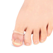 Load image into Gallery viewer, Ingrown Toenail Corrector Ring Elastic Washable Reusable Toenail Correction Silicone Ring Paronychia Restoration Tool
