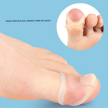 Load image into Gallery viewer, Ingrown Toenail Corrector Ring Elastic Washable Reusable Toenail Correction Silicone Ring Paronychia Restoration Tool
