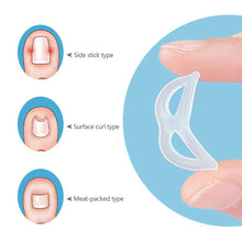Load image into Gallery viewer, Ingrown Toenail Corrector Ring Elastic Washable Reusable Toenail Correction Silicone Ring Paronychia Restoration Tool
