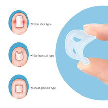 Load image into Gallery viewer, Ingrown Toenail Corrector Ring Elastic Washable Physically Fixed Toenail Silicone Ring Paronychia Restoration Tool
