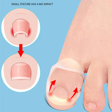 Load image into Gallery viewer, Ingrown Toenail Corrector Ring Elastic Washable Physically Fixed Toenail Silicone Ring Paronychia Restoration Tool
