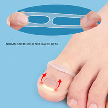 Load image into Gallery viewer, Ingrown Toenail Corrector Ring Elastic Washable Physically Fixed Toenail Silicone Ring Paronychia Restoration Tool
