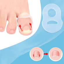 Load image into Gallery viewer, Ingrown Toenail Corrector Ring Elastic Washable Physically Fixed Toenail Silicone Ring Paronychia Restoration Tool
