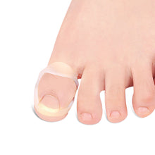 Load image into Gallery viewer, Ingrown Toenail Corrector Ring Elastic Washable Physically Fixed Toenail Silicone Ring Paronychia Restoration Tool
