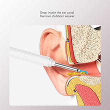Load image into Gallery viewer, Intelligent Visual Luminous Ear Pick Wireless Rechargeable High-Definition Ear Endoscope Ear Wax Cleaning Ear Care Tool
