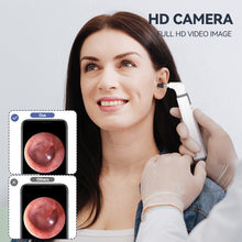 Load image into Gallery viewer, WIFI Digital Ear Camera Endoscope 3.9mm Wireless Otoscope Ear Inspection Tool Ear Wax Cleaner Removal Tools for Iphone Android

