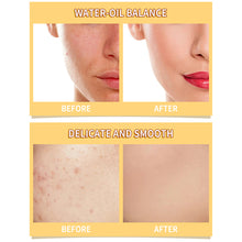 Load image into Gallery viewer, Skincare Products Vitamin C Facial Serum Brighten Skin Lighten Spots Hyaluronic Acid Face Essence Anti-aging Skin Care Products 15ml

