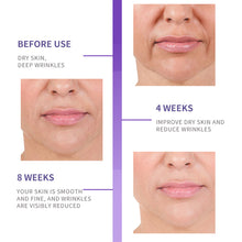Load image into Gallery viewer, Retinol Serum Anti Wrinkle Whiting Anti-aging Repair Natural Ingredients Vitamin C Facial Serum Whiten Face Skincare Essence Skin Care Products
