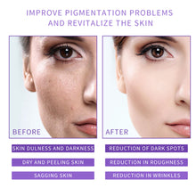 Load image into Gallery viewer, Retinol Serum Anti Wrinkle Whiting Anti-aging Repair Natural Ingredients Vitamin C Facial Serum Whiten Face Skincare Essence Skin Care Products
