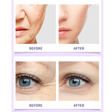 Load image into Gallery viewer, Retinol Serum Anti Wrinkle Whiting Anti-aging Repair Natural Ingredients Vitamin C Facial Serum Whiten Face Skincare Essence Skin Care Products

