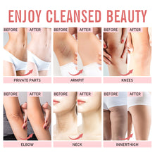 Load image into Gallery viewer, Whitening Cream Knee Buttocks Dark Skin Bleach Improve Melanin Pigmentation Dull Moisturizing Brighten 30ml
