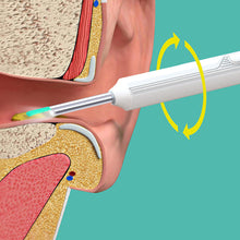 Load image into Gallery viewer, Visual Ear Digging Spoon Wireless Cleaning Endoscope Household HD Ear Collecting Ear Digging Spoon Ear Health Care
